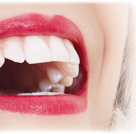 Incredible Tips To Keep Teeth White All The Time