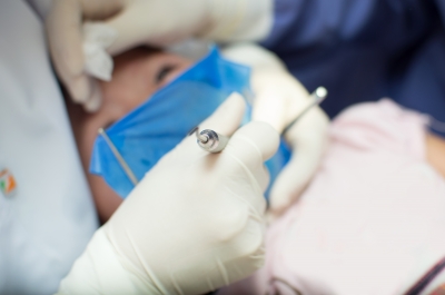 Great Ideas On How To Fight Plaque And Tartar Build Up the Right Way