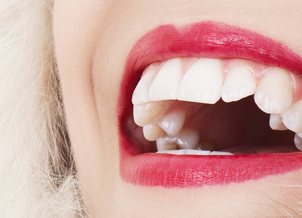 Three Pivotal Tips To Aid In Keeping Teeth White All The Time