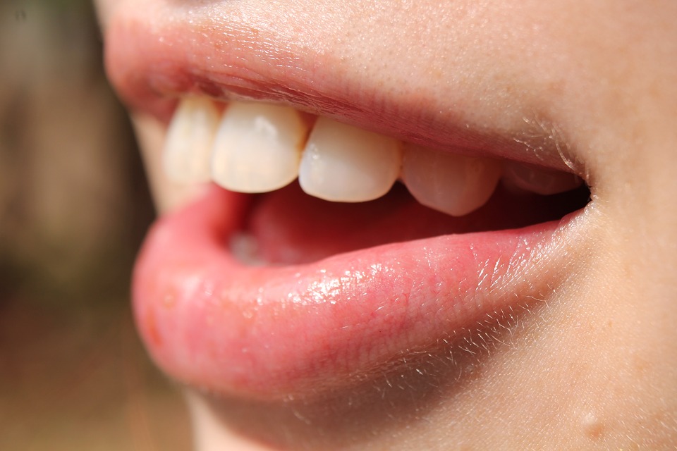 Understanding The Lifespan Of Veneers