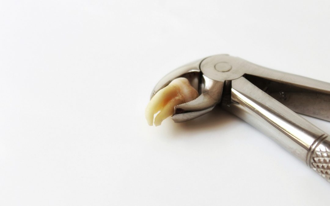 Learn How To Deal With Wisdom Teeth and Wisdom Teeth Removal Procedures