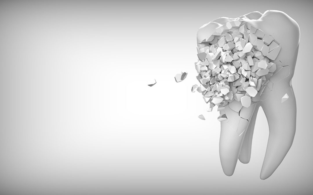 Cavity Dentist Rancho Cucamonga Dentist