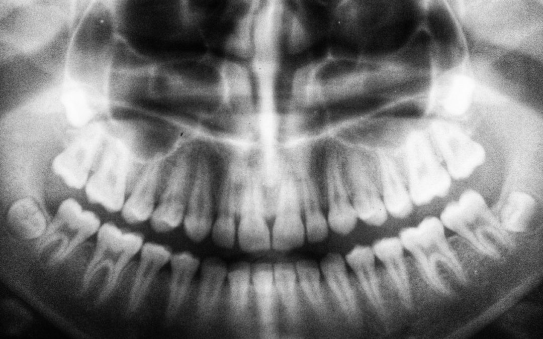 Restoration Of Teeth – Rancho Cucamonga Dentists