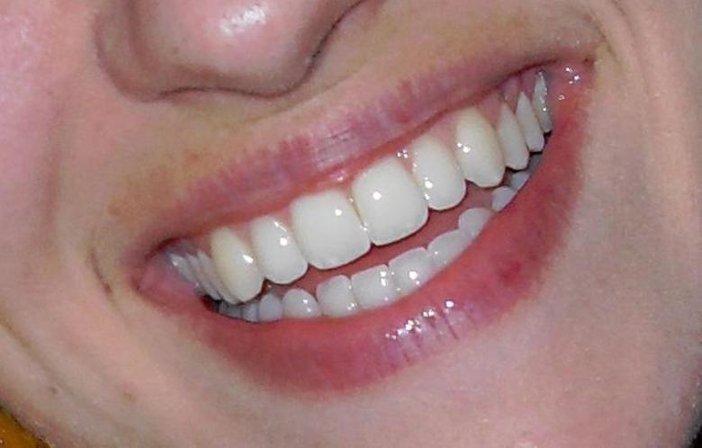 Amazing Dentistry Solutions To Help In Fixing Your Smile