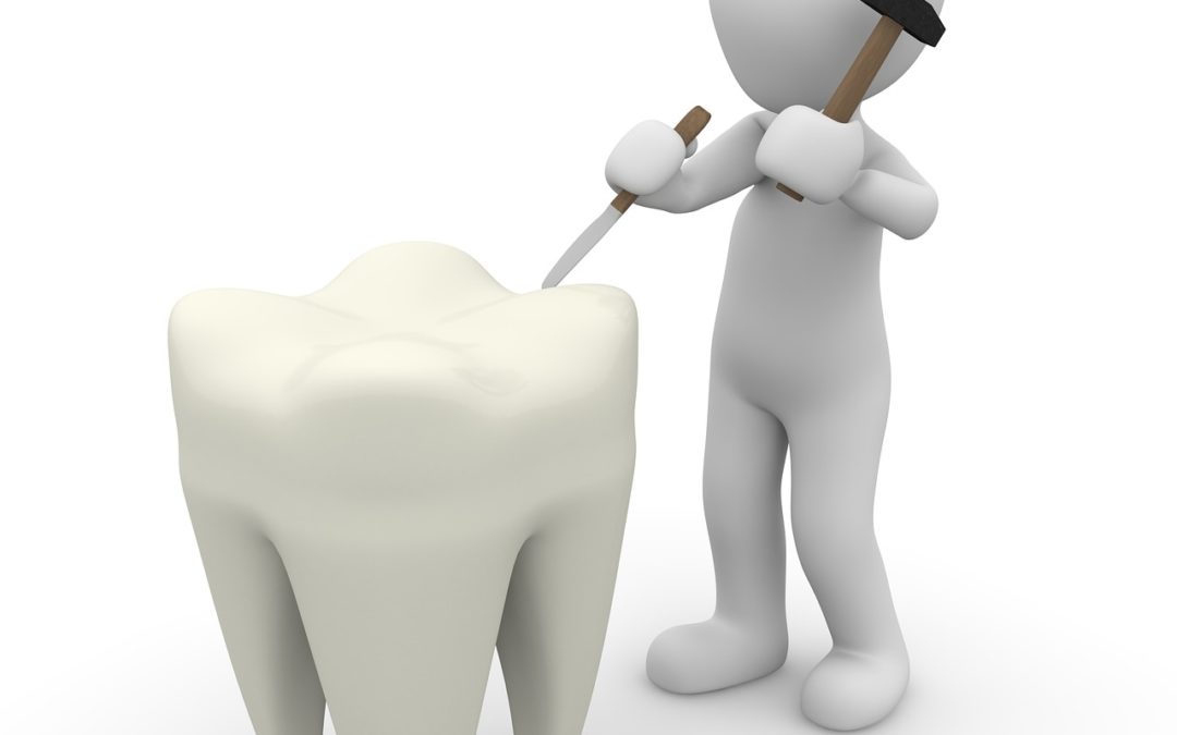 Getting A Much Better Idea of What Causes Sensitive Teeth