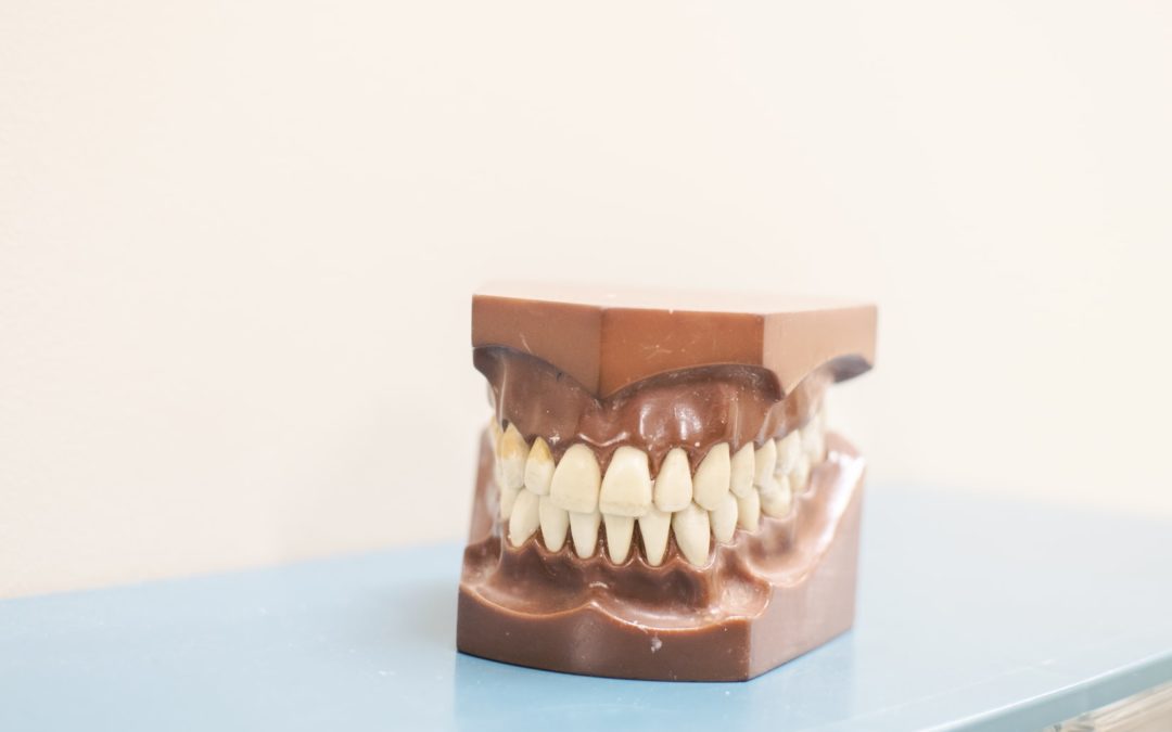 Tips On Whitening Or Replacing Your Veneers