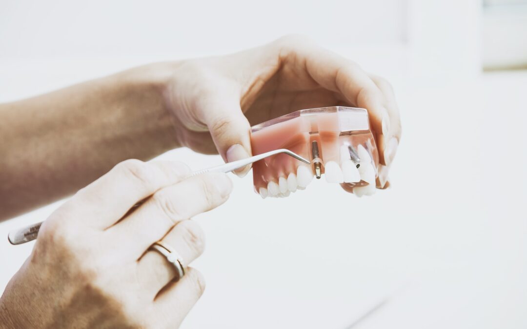 An Assortment Of Crucial Dental Tips When Handling Plaque
