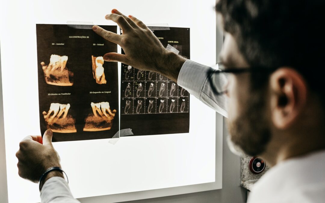 Tips On Knowing How Dental Implants Work