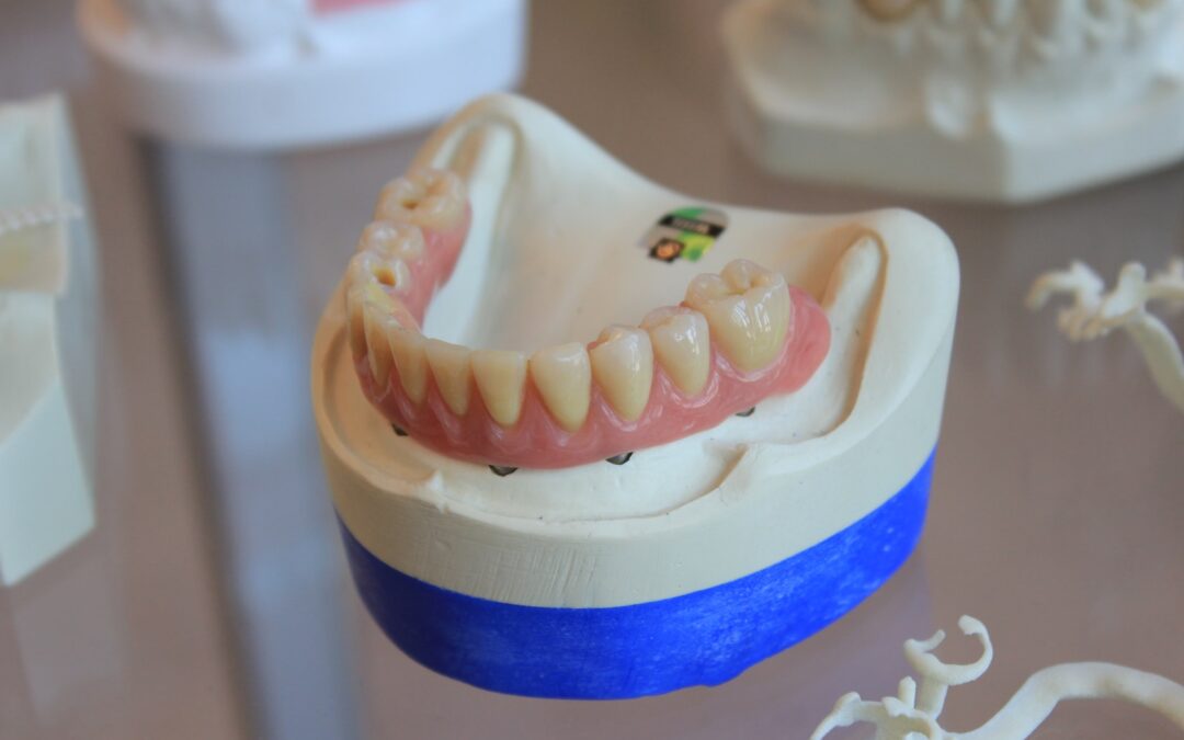 Getting A Better Idea Of What Dentures Are Made Of