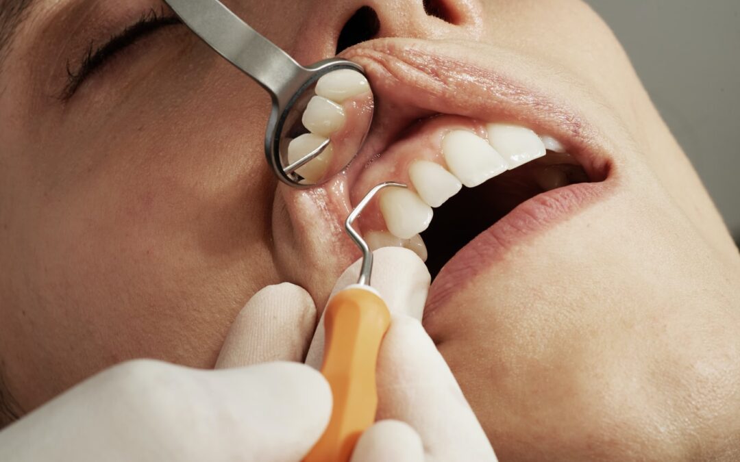 What Are Your Options When It Comes To Toothache Medicine?