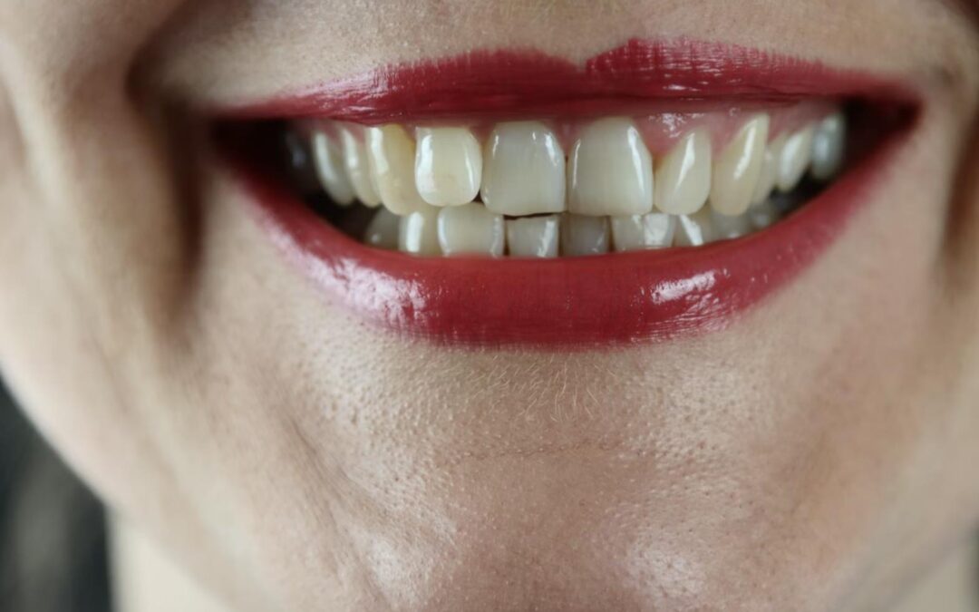 10 Causes Of Yellow Teeth And How To Properly Avoid Them